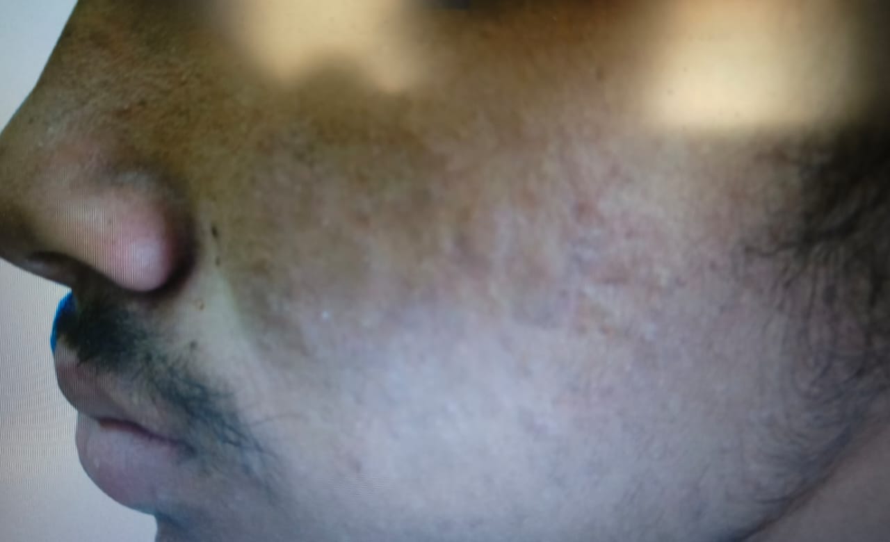 Patients Before and After